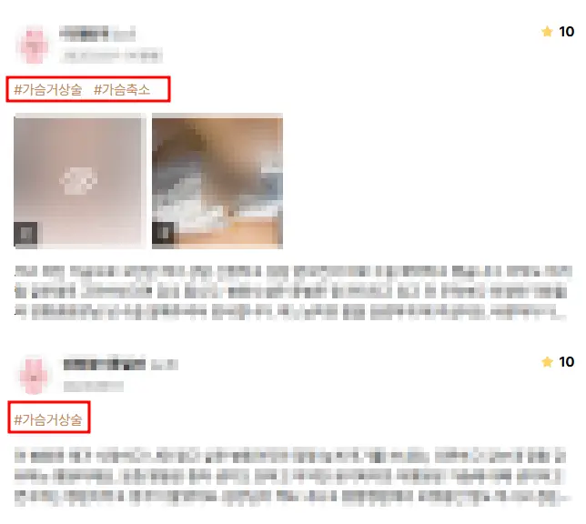 产后胸部下垂,以为只用假体填充上胸就够了? — 正文图片 8