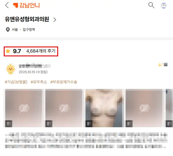 江南胸部手术,在哪里做比较好?<以20年研究经验为您建议> — 正文图片 2