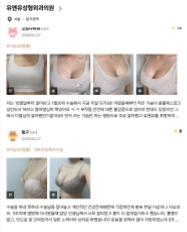 乳房提升手术费用?先打听价格也没有意义的原因。 — 正文图片 5