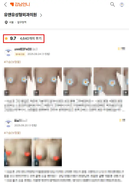 乳房假体破裂,一定要做MRI吗?是不是也能用超声检查 — 正文图片 2