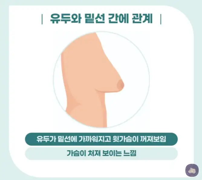 乳房提升术费用、价格?由去年仅假体隆胸就达3023例的一家医院为您讲解。 — 正文图片 5