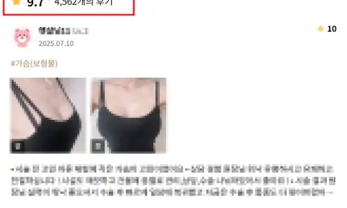 取出胸部假体? 用论文整理的疼痛、恢复期、身体变化 — 正文图片 14