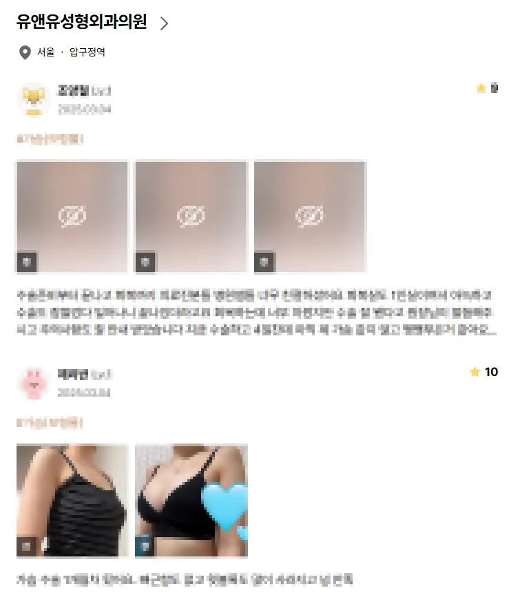 乳房提升手术费用?先打听价格也没有意义的原因。 — 正文图片 6