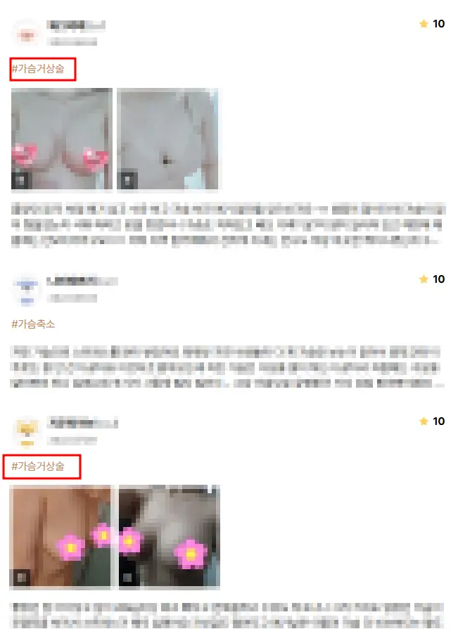 产后胸部下垂,以为只用假体填充上胸就够了? — 正文图片 9