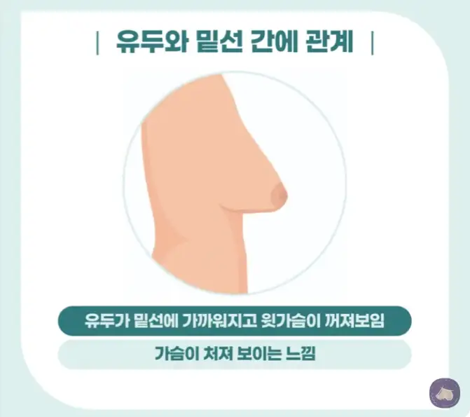 胸部下垂手术费用?别被别人的评价所迷惑。 — 正文图片 4