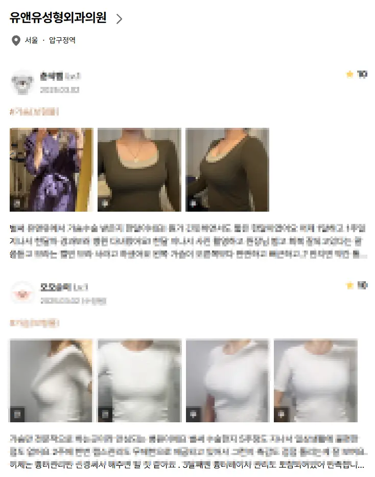 乳房提升手术费用?先打听价格也没有意义的原因。 — 正文图片 7