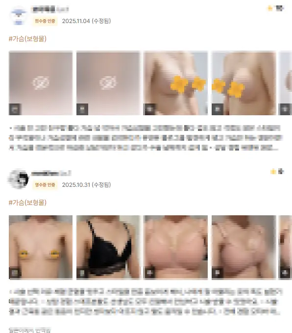 狎鸥亭隆胸整形外科,“只看主刀院长的评价就行”是一种误区 — 본문 이미지