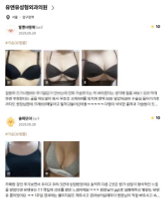 20多年来只研究胸部整形的记录