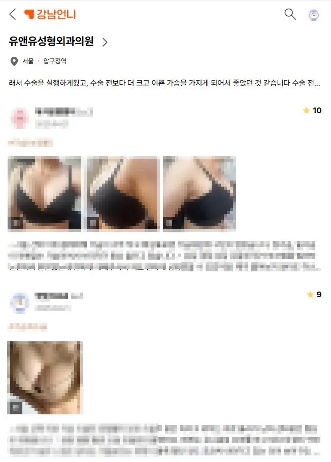 胸部手术后下垂,假体都放进去了,会不会更严重? — 正文图片 2
