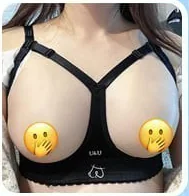 仅佩戴塑形文胸的隆胸术后即刻状态
