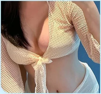披着透视罩衫的隆胸术后照片