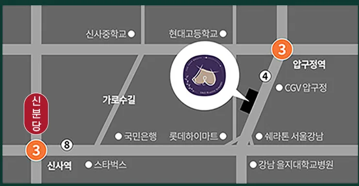 U&U整形外科路线简图 — 狎鸥亭站4号出口步行5分钟,新沙洞林荫路附近