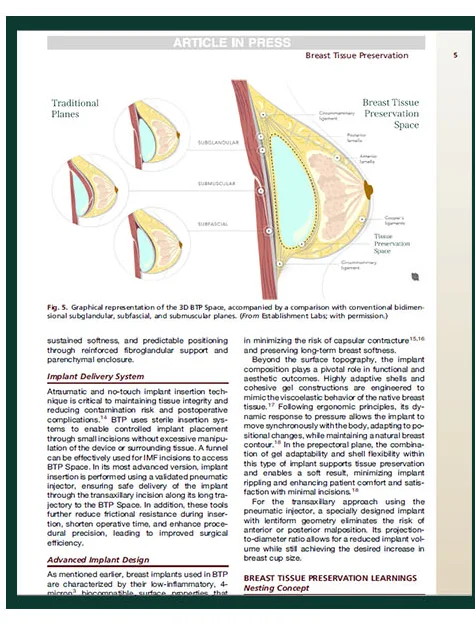 Clinics in Plastic Surgery刊载论文正文 — 3D BTP Space图解