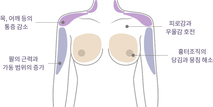 Happy Breast 普拉提 img3 m