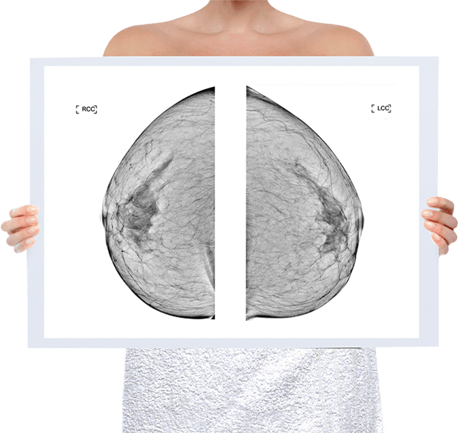 Healthy Breast 乳腺X线摄影 img5 m