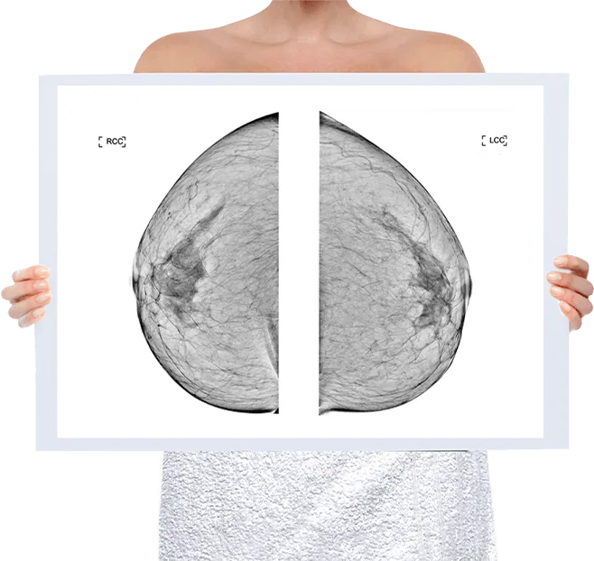 Healthy Breast 乳腺X线摄影 img5 m
