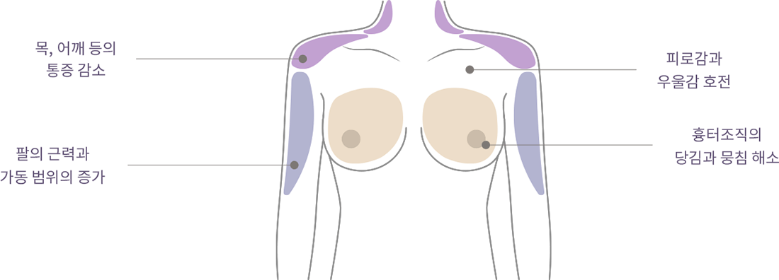 happy breast 普拉提 img3